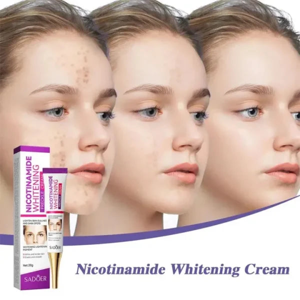 Nicotinamide Whitening Freckles Cream